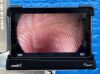 ARTHREX Synergy HD3 Tower Laparoscope