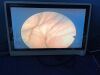 STRYKER VisionPro 26" LED VisionPro  26