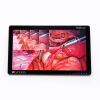 STERIS RLM27HD2 Display Monitor