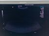 SIEMENS ACUSON ANTARES 4C1 08258525 Ultrasound Transducer