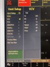 GE DATEX-OHMEDA S/5 Anesthesia  YOM: 2008  Anesthesia Machine