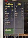 GE DATEX-OHMEDA S/5 Anesthesia  YOM: 2008  Anesthesia Machine