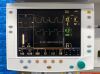 GE DATEX-OHMEDA S/5 Anesthesia  YOM: 2008  Anesthesia Machine
