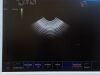 ESAOTE MyLab 20 Ultrasound - OB / GYN - Vascular