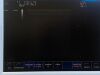 ESAOTE MyLab 20 Ultrasound - OB / GYN - Vascular