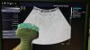 SIEMENS ACUSON ANTARES 6C2 Ultrasound Transducer