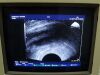 HITACHI EUP-331 Ultrasound Transducer