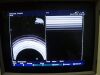 HITACHI EUP-331 Ultrasound Transducer