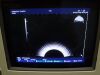 HITACHI EUP-331 Ultrasound Transducer