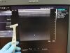 SIEMENS 14L5 Ultrasound Transducer