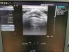 SIEMENS 14L5 Ultrasound Transducer
