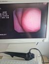 OLYMPUS CYF-V Cystoscope