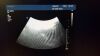 PHILIPS C9-4 convex Ultrasound Transducer