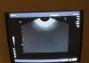 TOSHIBA PVF 621VT 6 Mhz Ultrasound Transducer