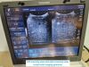 TOSHIBA viamo Ultrasound - OB / GYN - Vascular