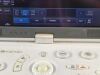 TOSHIBA viamo Ultrasound - OB / GYN - Vascular