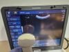 TOSHIBA viamo Ultrasound - OB / GYN - Vascular