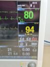 GE B650 ICU/CCU