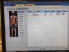 PHILIPS BrightView XCT SPECT/CT