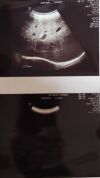 GE C1-5-RS Ultrasound Transducer