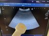 TOSHIBA Xario 200 Ultrasound System