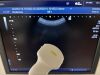 TOSHIBA Xario 200 Ultrasound System