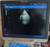 TOSHIBA PST-25BT Ultrasound Transducer
