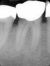 SOREDEX Minray Dental X-Ray