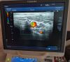 TOSHIBA PLT-805AT Ultrasound Transducer