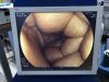 FUJIFILM EC-590ZW/M Colonoscope