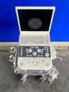 SIEMENS ACUSON P300 Portable Ultrasound System