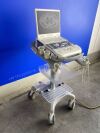 SIEMENS ACUSON P300 Portable Ultrasound System
