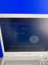 SIEMENS ACUSON P300 Portable Ultrasound System