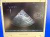SIEMENS ACUSON P300 Portable Ultrasound System