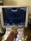 HITACHI Avius HI Vision Ultrasound System