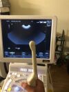 HITACHI Avius HI Vision Ultrasound System