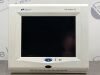 SPACELABS HEALTHCARE 91367 Monitor