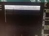 BK MEDICAL ProFocus 2202 Ultrasound - Shared Service