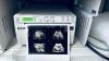 GE VOLUSON E10 Ultrasound - OB / GYN