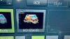 GE VOLUSON E10 Ultrasound - OB / GYN