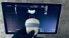 GE VOLUSON E10 Ultrasound - OB / GYN