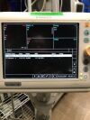 PHILIPS SureSigns V3 Monitor