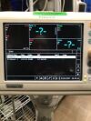 PHILIPS SureSigns V3 Monitor