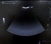 GE LOGIQ E9 Ultrasound
