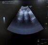 GE LOGIQ E9 Ultrasound