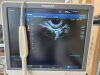 TOSHIBA PVU-770ST Ultrasound - OB / GYN