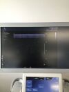 SUPERSONIC IMAGINE AIXplorer Ultrasound - OB / GYN - Vascular
