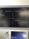 SUPERSONIC IMAGINE AIXplorer Ultrasound - OB / GYN - Vascular