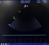 GE VIVID I Ultrasound
