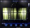 GE VIVID I Ultrasound
